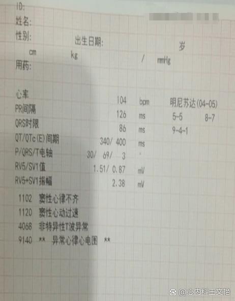 一个月不规则心率9次