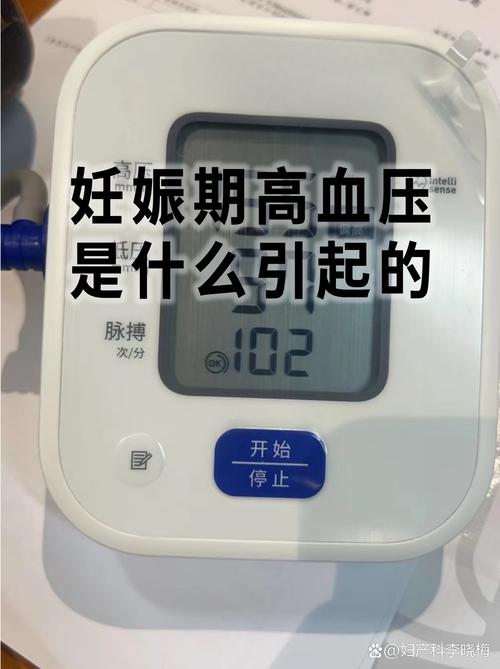 更年期女性QTC偏高