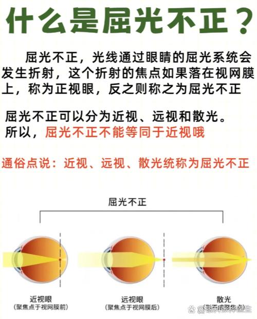 眼睛重影会自动恢复吗