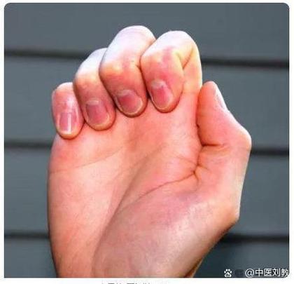 三秒把手指头粘一起怎么办