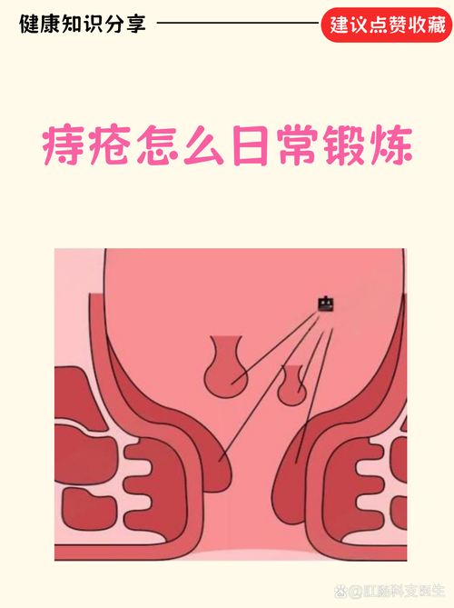 痔疮术后做提肛有啥好处