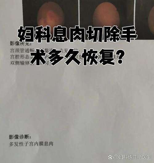 做子宫息肉手术多久才能恢复正常