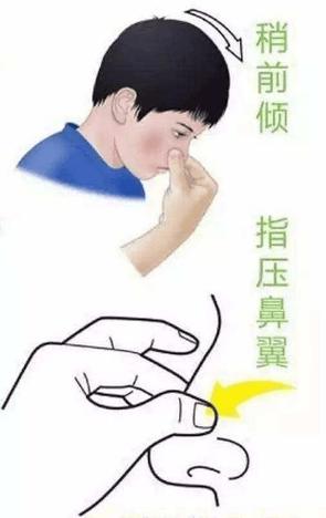 站怎么办 我要流鼻血了