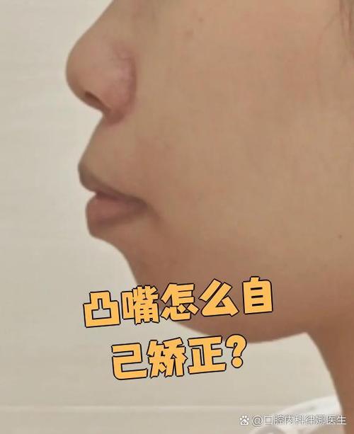 口呼吸的嘴凸后期可以矫正吗