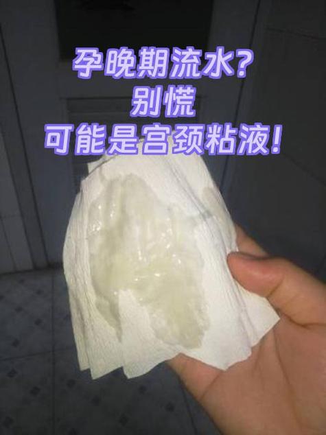 产生文(女孕大肚)孕妇生完又怀图标