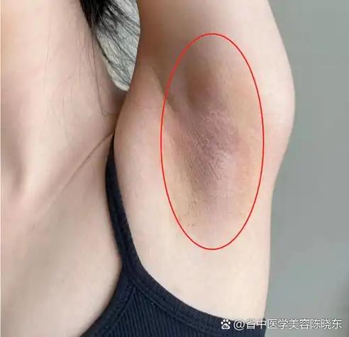 腋下异味怎么解决根除