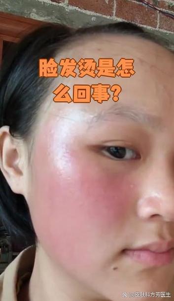 为什么脸莫名其妙发烫