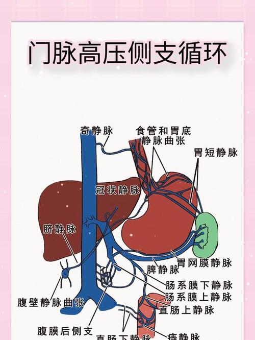 门脉高压是怎么回事