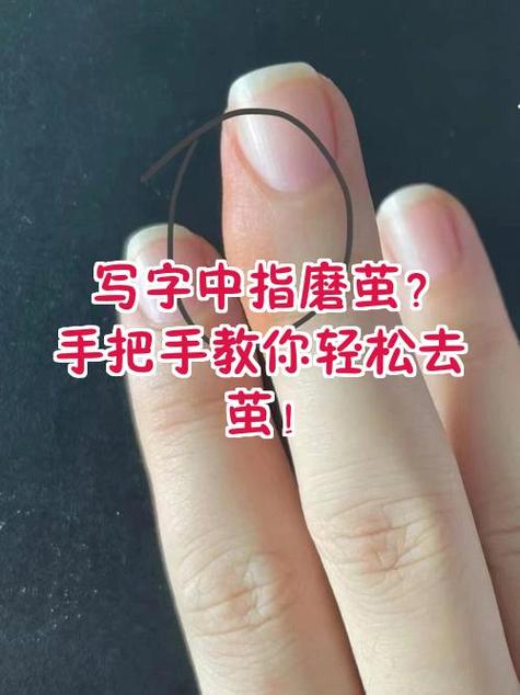 去除手上茧子小妙招