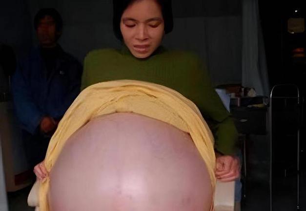 怀孕寄生肚子变大