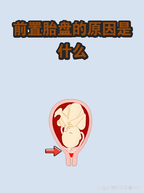 前置相机弹出失败的原因截图