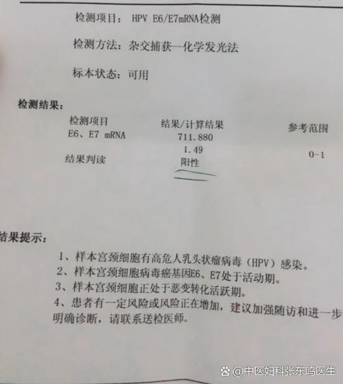 e病毒感染是什么意思