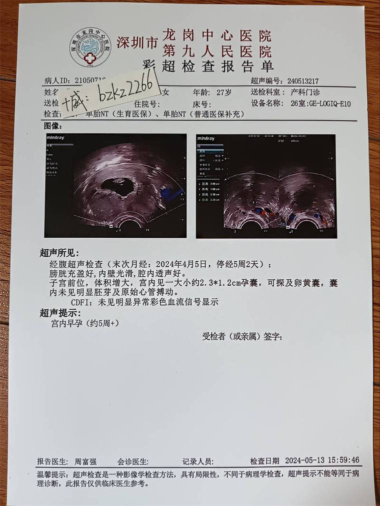 b超afi是什么意思