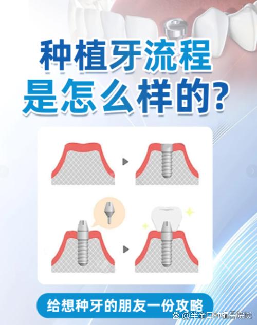 韩国奥齿泰种植牙费用