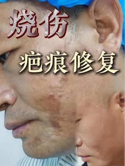 刀片划伤的伤疤可以修复吗