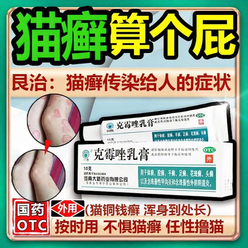 人得猫癣涂什么好得快缩略图