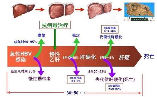 乙肝是怎么感染上的