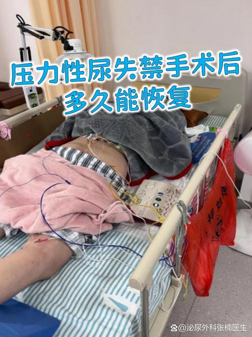 漏尿手术一般住院几天
