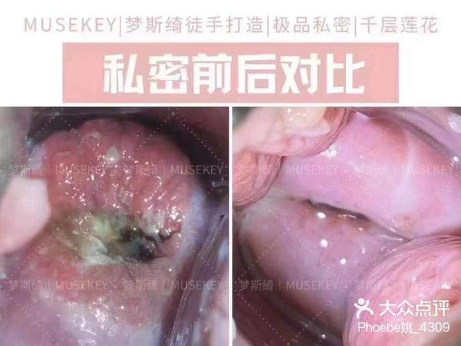 私密长白毛了怎样才能变黑