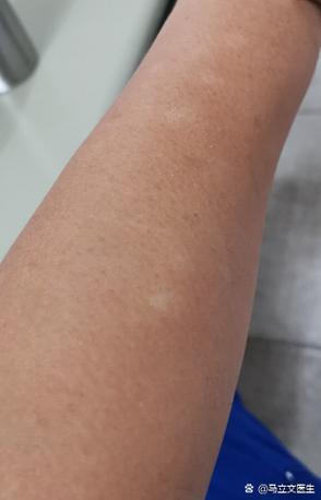 手机后盖小白点原因图标