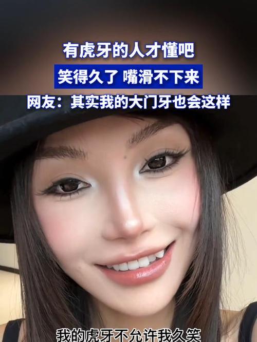 世界上全部人都有虎牙吗图标