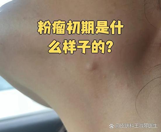 皮肤里有块状的东西是什么