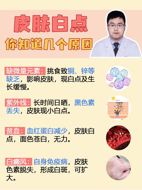 身上长白点是什么原因