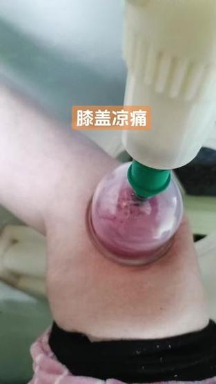 真空拔罐器使用方法视频教程缩略图