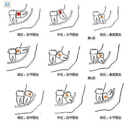 口腔LR是左下还是右下