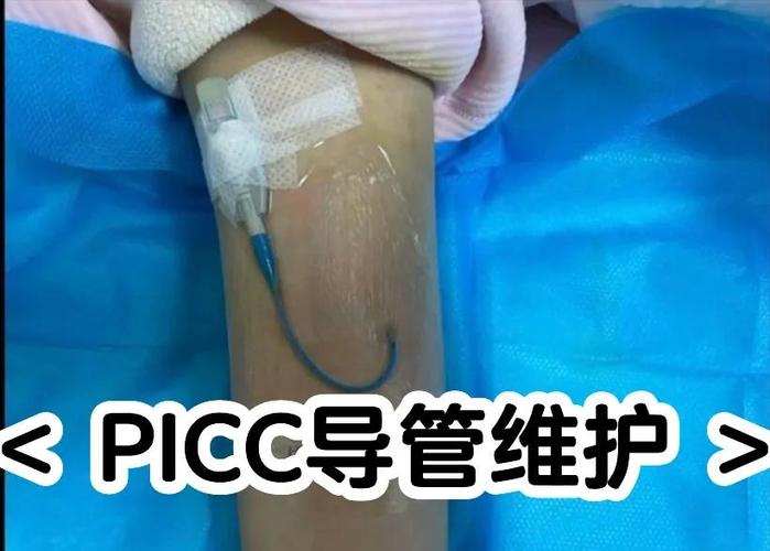 picc什么样子图片