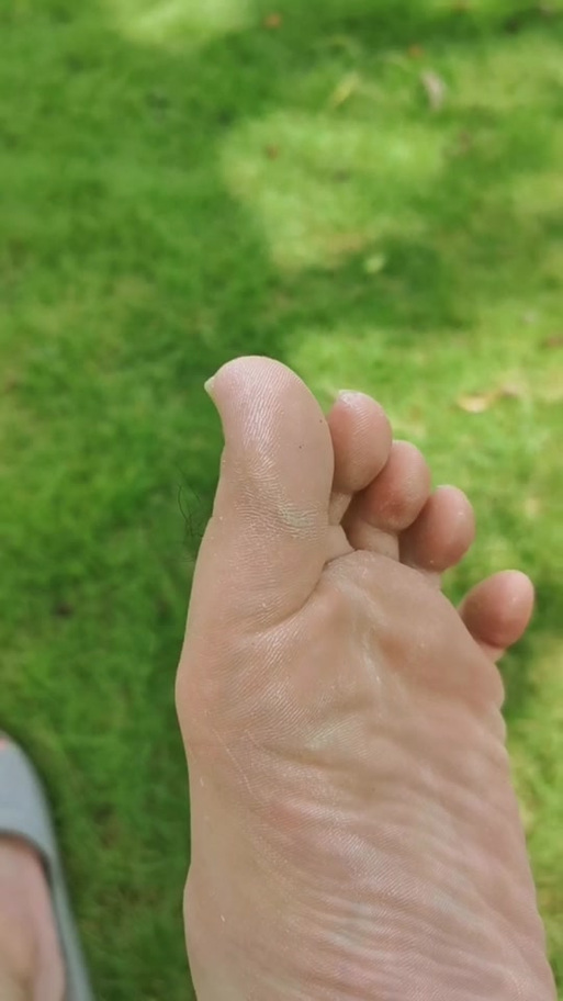 小蚂蚁脚心截图