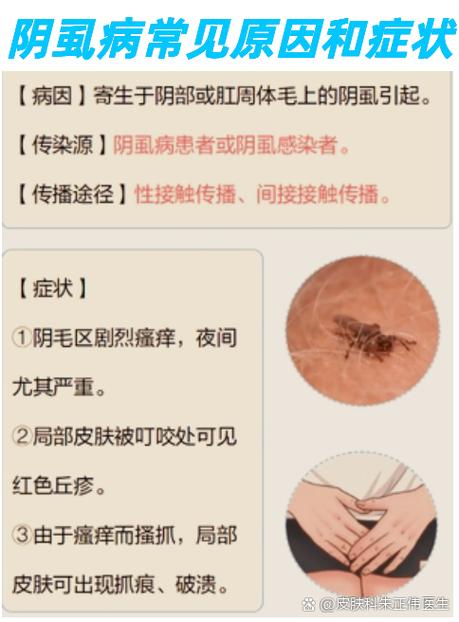 男身体下面瘙痒是怎么回事