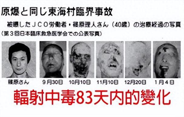 核辐射多久会消失