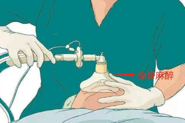 外国手术麻醉视频缩略图