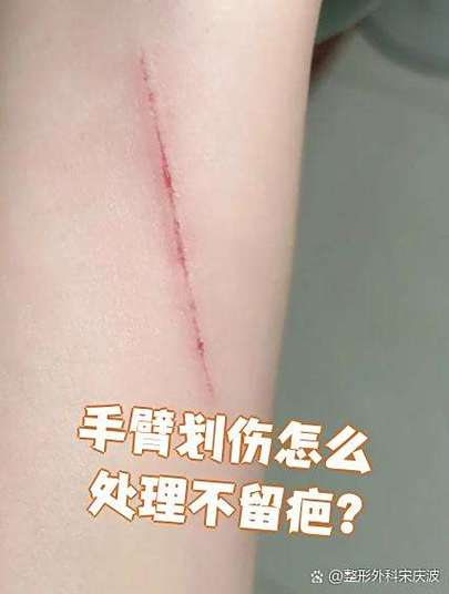 身上无故出现划痕伤口图标