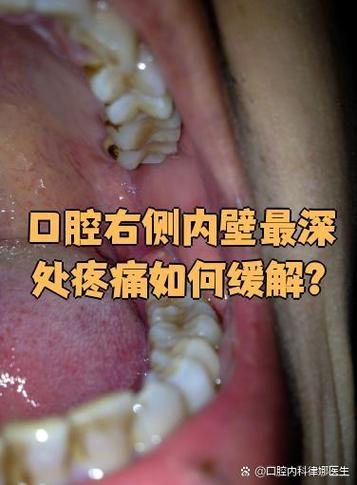 挂钩疼一张嘴就痛怎么治疗