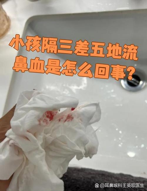 儿童隔三差五的流鼻血