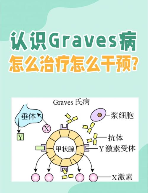 graves病能治愈吗