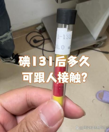 碘131人一般活不过40天吗