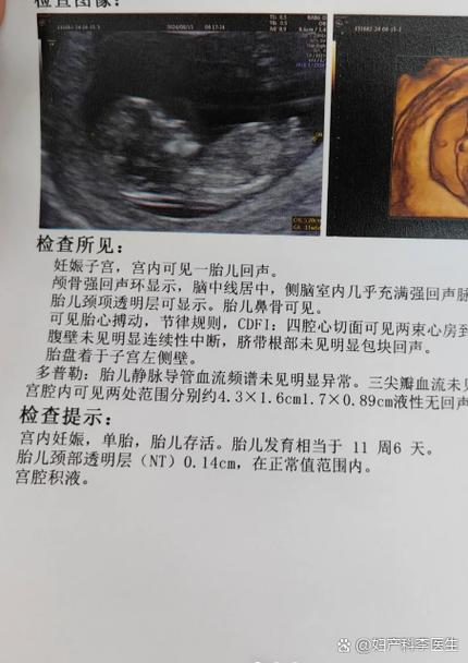 12周nt值对照表