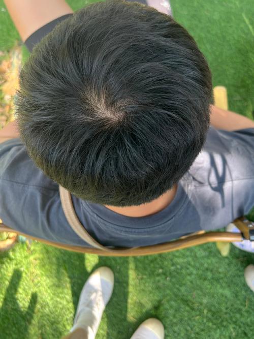 头顶上的旋怎么形成的图标
