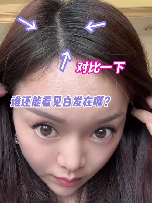 白发不想染了怎么解决