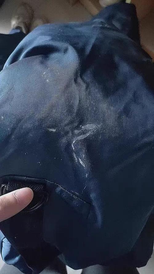胶粘在羽绒服上怎么去除游戏截图