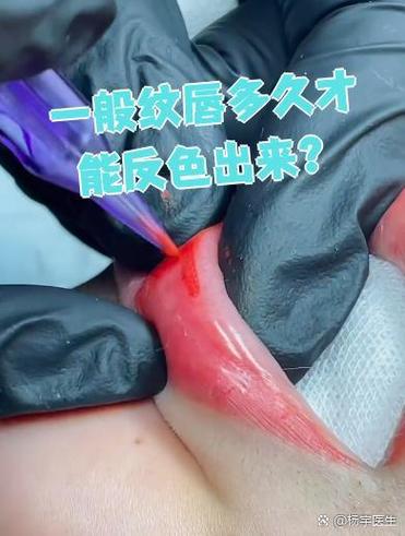 纹唇多久反色最好看