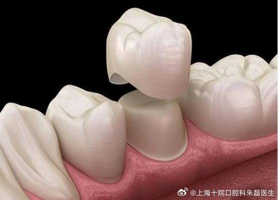 补牙的牙套坏了怎么办