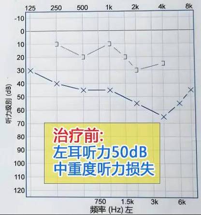 声音可以判断出大致年龄吗