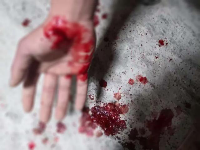 小碎玻璃渣子扎手里