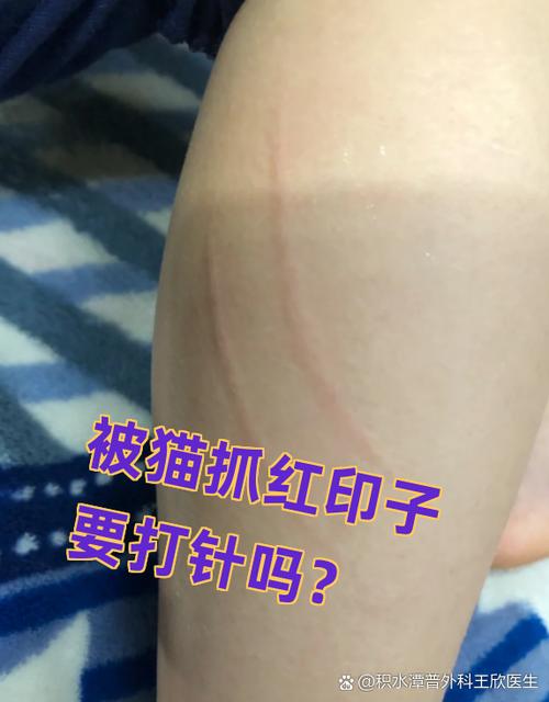 被猫抓了轻轻的划痕缩略图