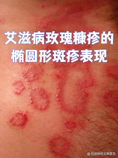 足浴店小姐吹宵会得艾滋病吗