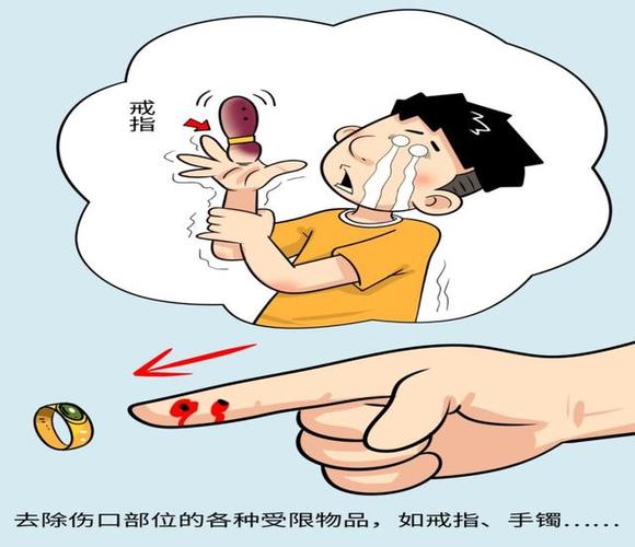 被仓鼠咬了把血挤出来了还有事吗